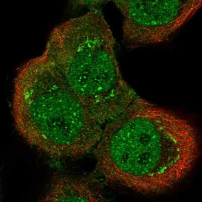 Immunocytochemistry/ Immunofluorescence: RICS Antibody [NBP1-92334]