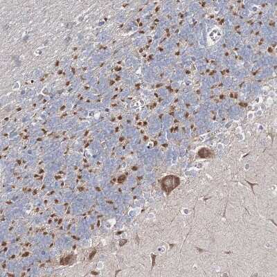 Immunohistochemistry: RICS Antibody [NBP2-38408]