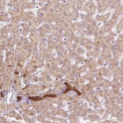 Immunohistochemistry: RICS Antibody [NBP2-38926]