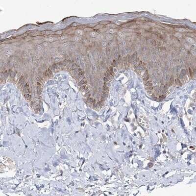 Immunohistochemistry-Paraffin: RICS Antibody [NBP1-92334]