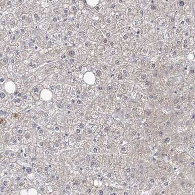 Immunohistochemistry-Paraffin: RICS Antibody [NBP1-92334]
