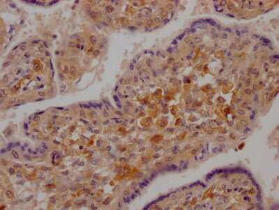 Immunohistochemistry: RIG-I Antibody (7F6) [NBP3-15174]