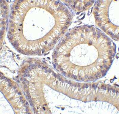 Immunohistochemistry: RIG-I Antibody - BSA Free [NBP1-76732]