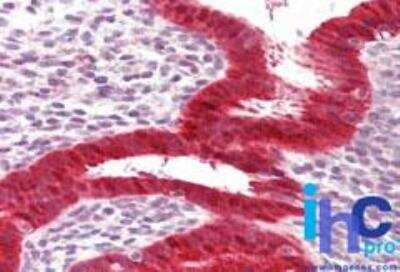 Immunohistochemistry-Paraffin: RIG-I Antibody - BSA Free [NBP2-27419]
