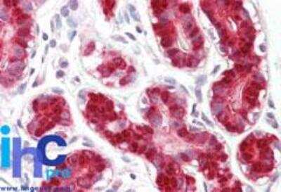 Immunohistochemistry-Paraffin: RIG-I Antibody - BSA Free [NBP2-27419]