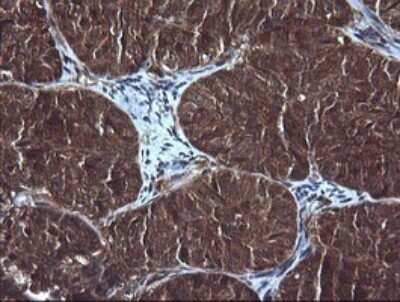 Immunohistochemistry: RIG-I Antibody (OTI6C1) - Azide and BSA Free [NBP2-73909]