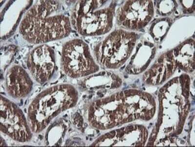 Immunohistochemistry: RIG-I Antibody (OTI6C1) - Azide and BSA Free [NBP2-73909]