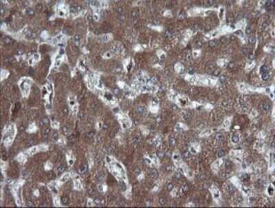 Immunohistochemistry: RIG-I Antibody (OTI6C1) - Azide and BSA Free [NBP2-73909]