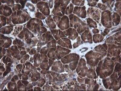 Immunohistochemistry: RIG-I Antibody (OTI6C1) - Azide and BSA Free [NBP2-73909]