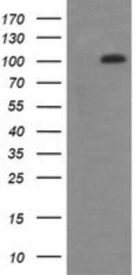 Western Blot: RIG-I Antibody (OTI6C1)Azide and BSA Free [NBP2-73909]