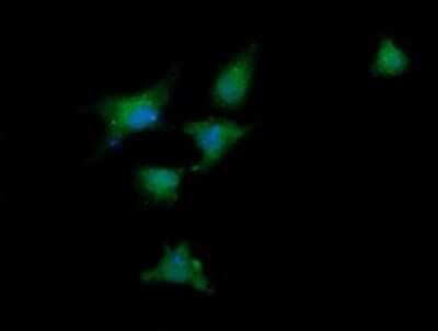 Immunocytochemistry/ Immunofluorescence: RIG-I Antibody (OTI6C1) [NBP2-45678]