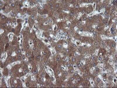 Immunohistochemistry: RIG-I Antibody (OTI6C1) [NBP2-45678]