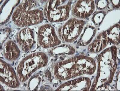Immunohistochemistry: RIG-I Antibody (OTI6C1) [NBP2-45678]