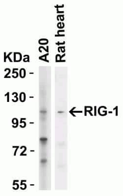 Western Blot: RIG-I AntibodyBSA Free [NBP1-76732]