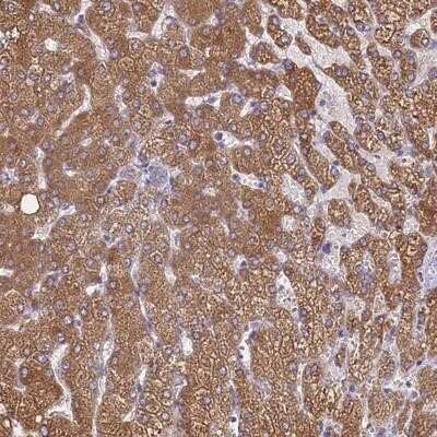Immunohistochemistry-Paraffin: RIIAD1 Antibody [NBP1-94117]