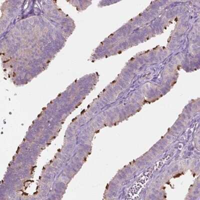 Immunohistochemistry-Paraffin: RIIAD1 Antibody [NBP1-94117]