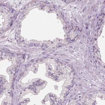 Immunohistochemistry-Paraffin: RIIAD1 Antibody [NBP1-94117]