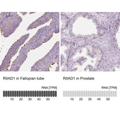 Immunohistochemistry-Paraffin: RIIAD1 Antibody [NBP1-94117]