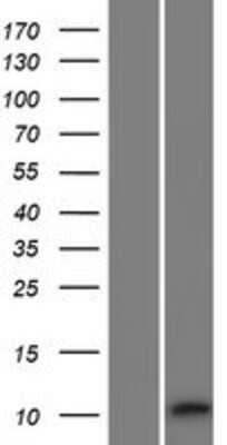 Western Blot: RIIAD1 Overexpression Lysate [NBP2-09721]