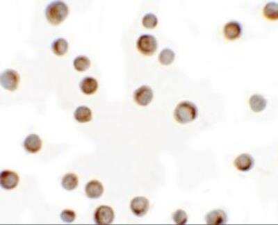 Immunocytochemistry/ Immunofluorescence: RILP Antibody - BSA Free [NBP2-81991]