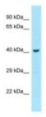 Western Blot: RILP Antibody [NBP1-98279]