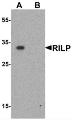 Western Blot: RILP AntibodyBSA Free [NBP2-81991]