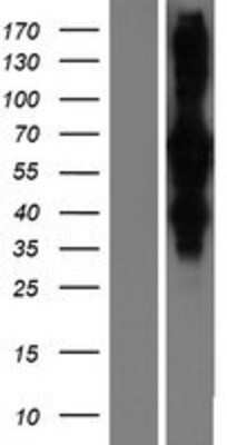 Western Blot: RILP Overexpression Lysate [NBP2-06126]