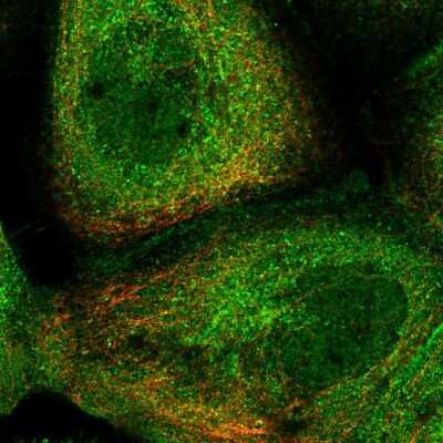 Immunocytochemistry/ Immunofluorescence: RILPL1 Antibody [NBP1-81928]