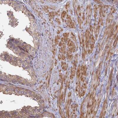 Immunohistochemistry-Paraffin: RILPL1 Antibody [NBP1-81928]