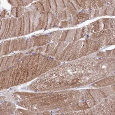 Immunohistochemistry-Paraffin: RILPL1 Antibody [NBP1-81928]