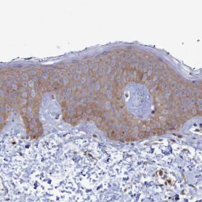 Immunohistochemistry-Paraffin: RILPL1 Antibody [NBP1-81928]