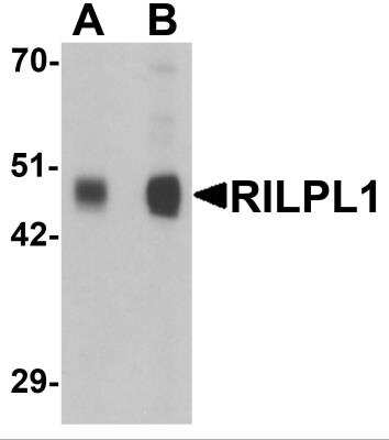 Western Blot: RILPL1 AntibodyBSA Free [NBP2-81992]