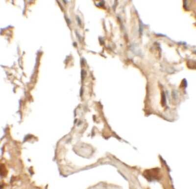 Immunohistochemistry: RILPL2 Antibody - BSA Free [NBP2-81993]