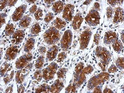 Immunohistochemistry-Paraffin: RILPL2 Antibody [NBP2-20162]