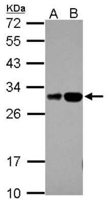 Western Blot: RILPL2 Antibody [NBP2-20162]