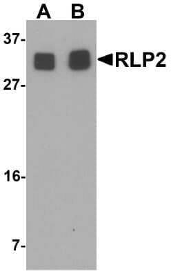 Western Blot: RILPL2 AntibodyBSA Free [NBP2-81993]