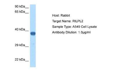 Western Blot: RILPL2 Antibody [NBP2-85638]