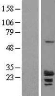 Western Blot: RILPL2 Overexpression Lysate [NBL1-15369]