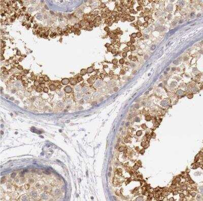 Immunohistochemistry-Paraffin: RIMBP3 Antibody [NBP1-81387]
