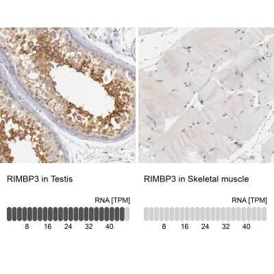 Immunohistochemistry-Paraffin: RIMBP3 Antibody [NBP1-81387]