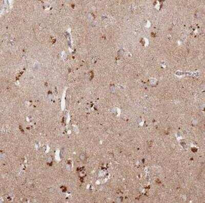 Immunohistochemistry-Paraffin: RIMS Binding Protein 2 Antibody [NBP2-30643]