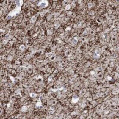 Immunohistochemistry-Paraffin: RIMS1 Antibody [NBP3-17172]