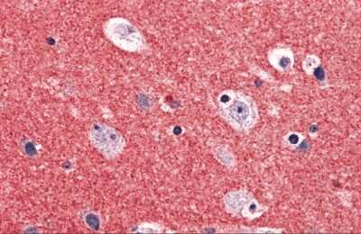 Immunohistochemistry-Paraffin: RIMS2 Antibody - BSA Free [NBP2-41078]