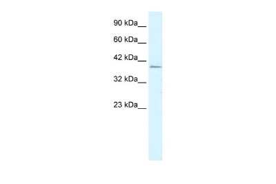 Western Blot: RIMS3 Antibody [NBP2-85639]