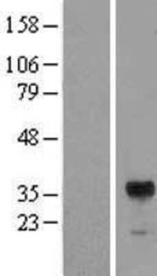 Western Blot: RIMS3 Overexpression Lysate [NBL1-15371]