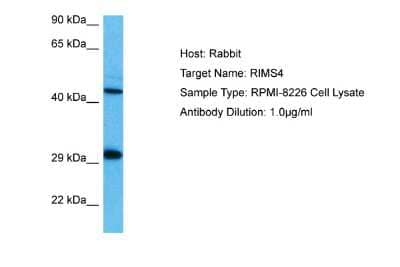 Western Blot: RIMS4 Antibody [NBP2-83447]