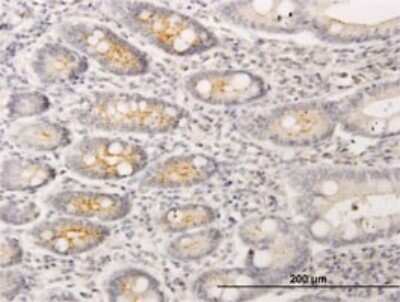 Immunohistochemistry-Paraffin: RIN2 Antibody (1E7) [H00054453-M01]
