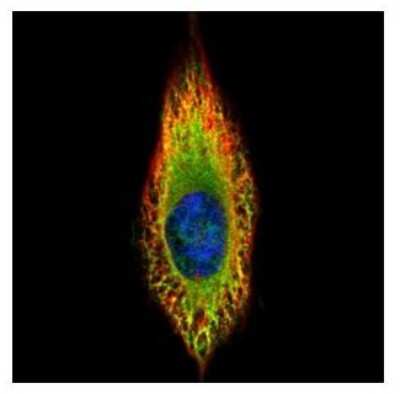 Immunocytochemistry/ Immunofluorescence: RIN2 Antibody [NBP2-20163]