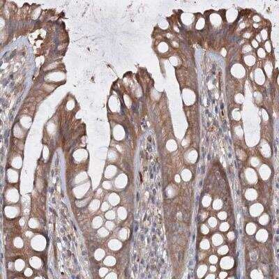 Immunohistochemistry: RIN2 Antibody [NBP1-80854]