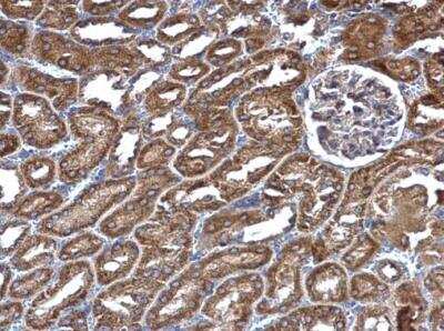 Immunohistochemistry-Paraffin: RIN2 Antibody [NBP2-20163]